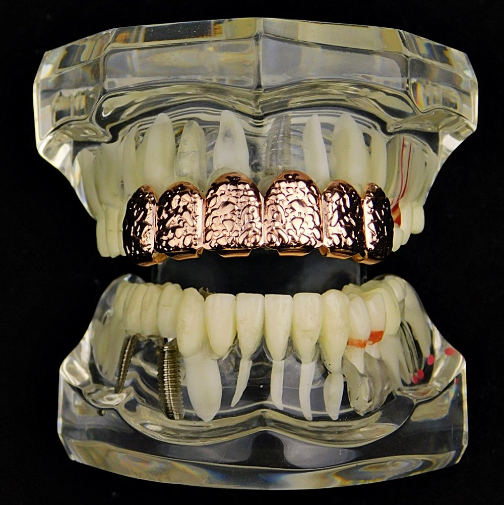 14K Rose Gold Plated Hip Hop Grillz - 6 Piece Upper Teeth Slugs for Men & Women | Perfect for Rappers, Performers & Hip Hop Fashion Enthusiasts