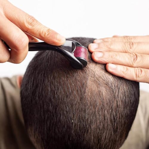 Professional SDF Derma Roller 1mm for Hair Regrowth & Skin Rejuvenation | 540 Titanium Microneedles | At-Home Micro-Needling Treatment for Men & Women | Perfect for Hair Care Routine & Anti-Aging Skincare