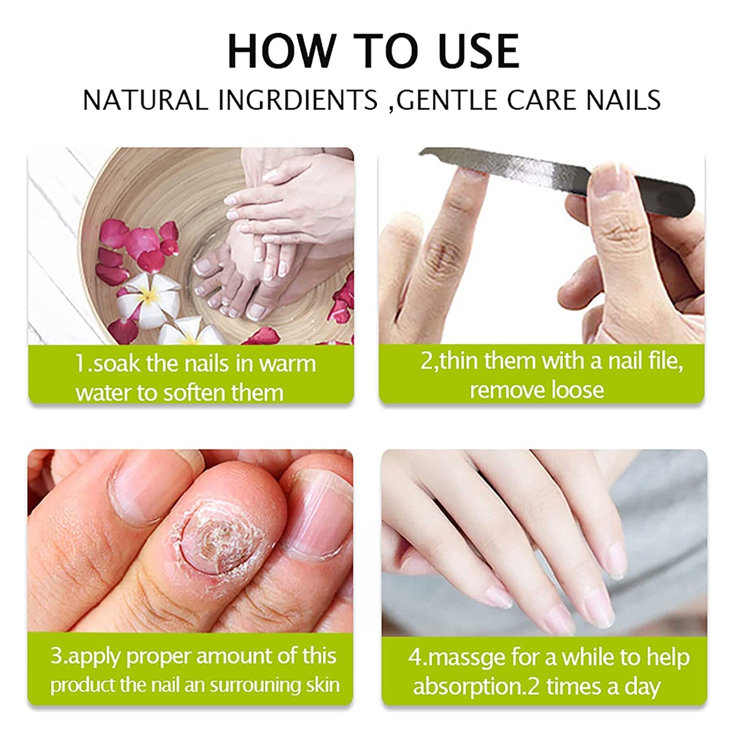Flyles Nail Repair Treatment Gel - Restores Discolored & Damaged Nails, Strengthens & Protects Natural Nails (2 Pack) | Perfect for Manicures, Nail Care Routine & Salon Treatments