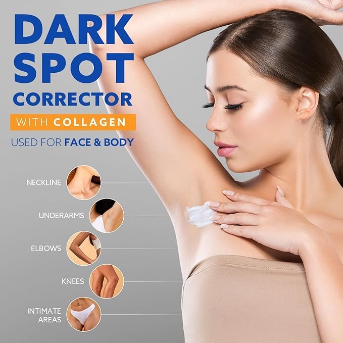 Dark Spot Remover Cream for Face & Body - Sun Spot & Age Spot Corrector Treatment (1.7 oz) | Brightening Skincare for Hyperpigmentation, Acne Scars & Uneven Skin Tone | Perfect for Daily Skincare Routine & Post-Sun Care