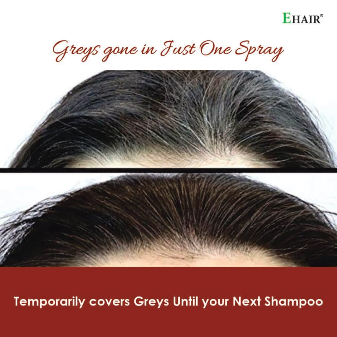 BEAUTYRELAY LONDON E Hair Ammonia-Free Natural Instant Hair Color Spray - Covers Gray & Black Hair Instantly, Easy to Use, Perfect Match & Blend for Brown Hair (1 Count) - Great for Touch-Ups, Root Coverage, and Quick Hair Color Fixes Between Salon Visits