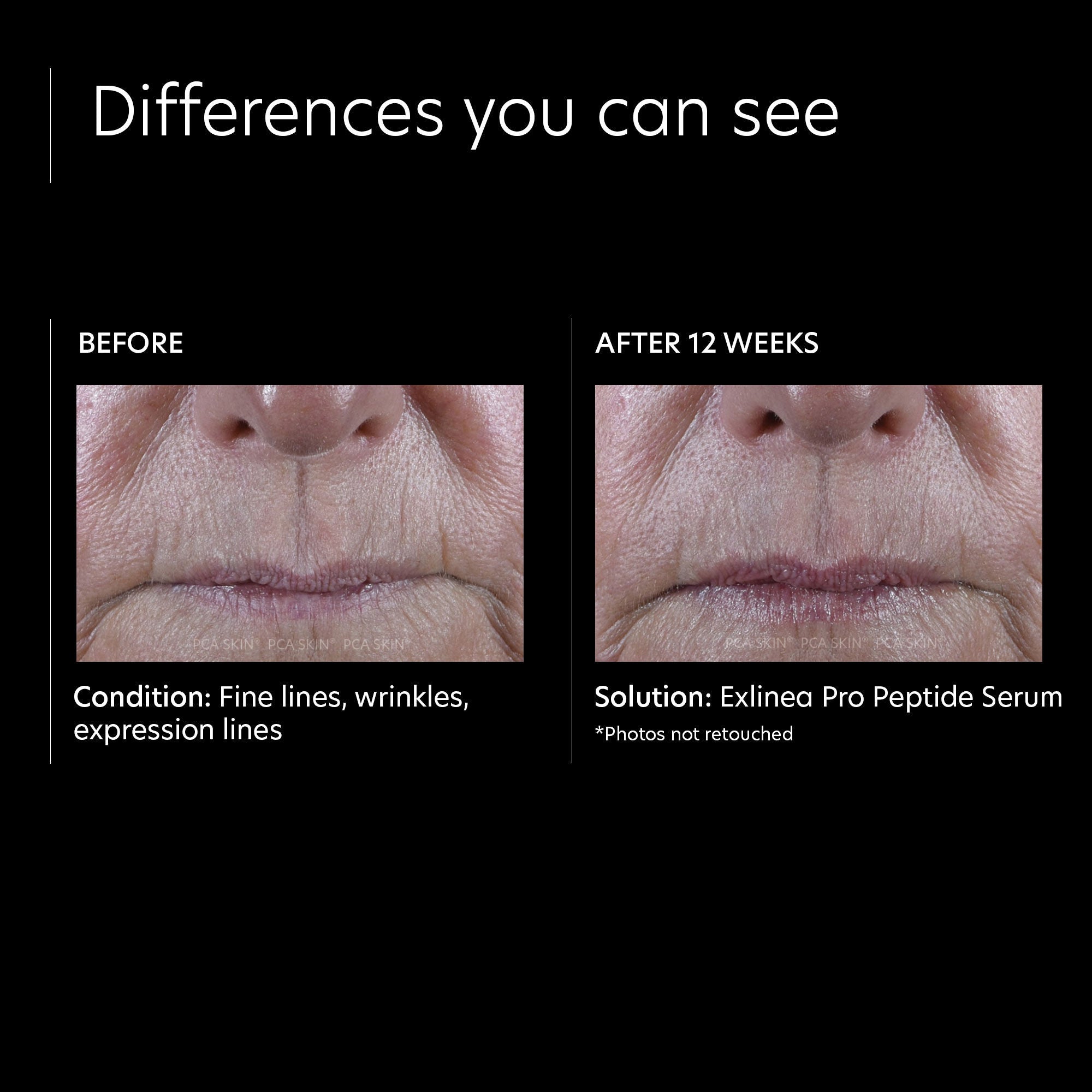 ExLinea Pro Peptide Serum - Anti-Aging Face Serum for Wrinkles & Fine Lines | Hydrating & Firming Skin Care Treatment for Daily Use at Home or Salon