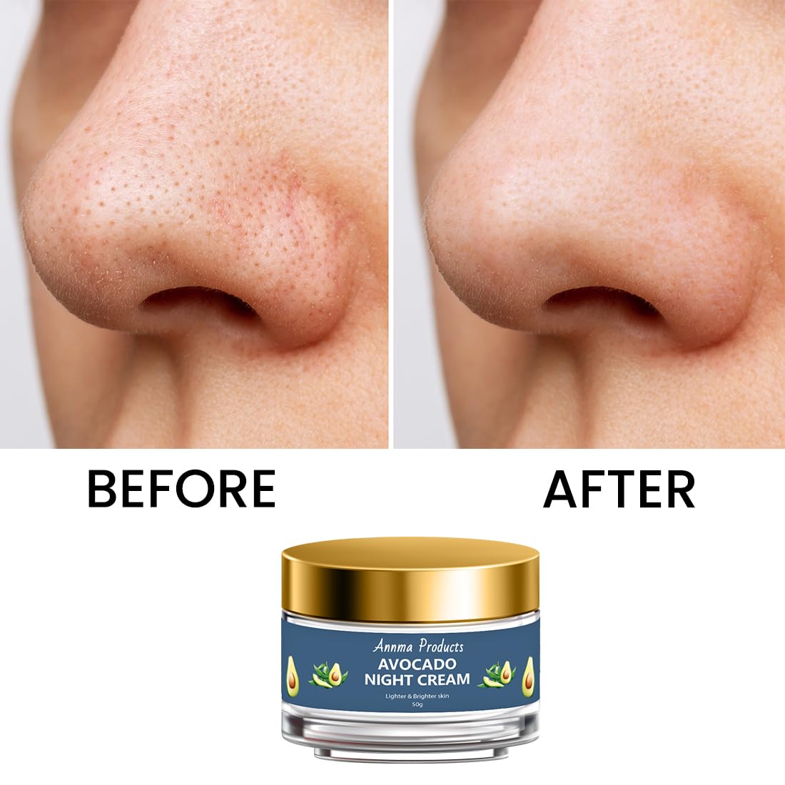Annma Avocado Night Cream - Anti-Aging, Deep Nourishing & Brightening Face Moisturizer for Women | 50g | Perfect for Dry Skin & Nighttime Skincare Routine