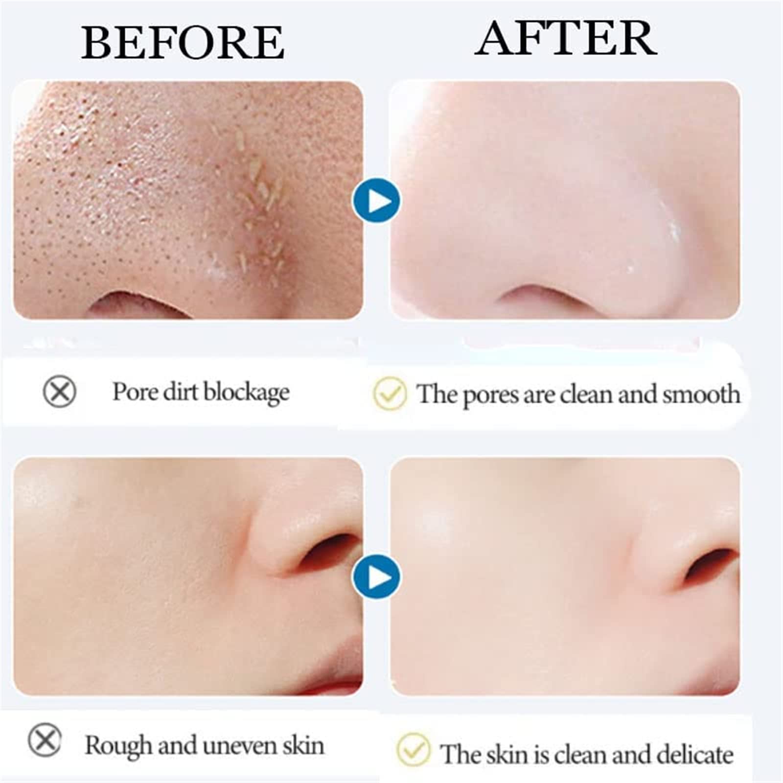 Oligopeptide Bubble Cleansing Essence - Deep Pore Cleanse, Blackhead Removal & Pore Minimizing Gel (3 Pack) | Gentle Face Wash for Acne-Prone & Sensitive Skin, Daily Skincare Routine