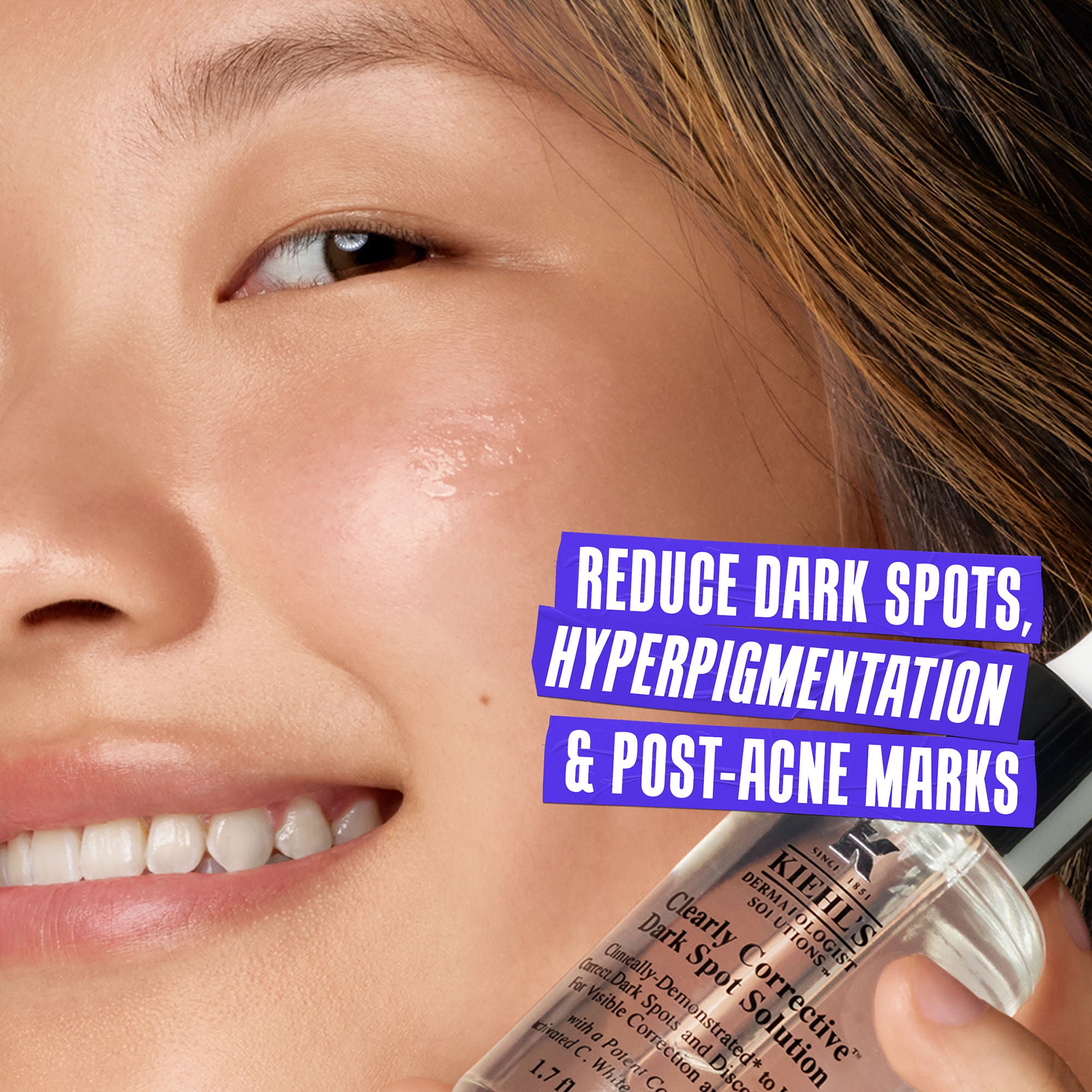 Kiehl's Clearly Corrective Dark Spot Solution - Brightening Serum for Hyperpigmentation & Uneven Skin Tone | Perfect for Daily Skincare Routine & Nighttime Use