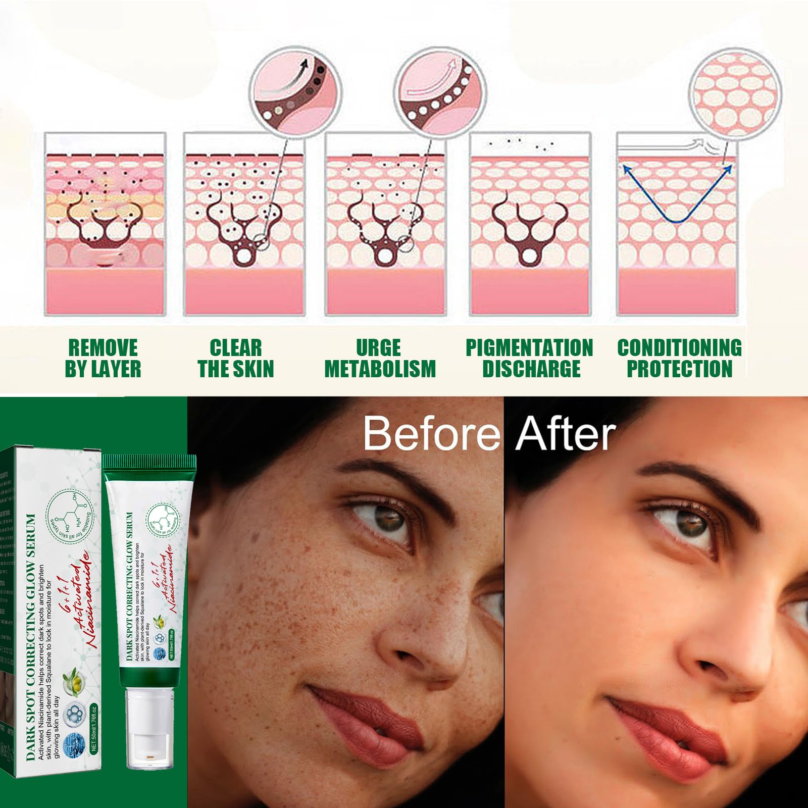 KOAHDE Anti Stain Face Serum & Dark Spot Correcting Cream - Skin Brightening, Lightening & Moisturizing Treatment for Hyperpigmentation & Uneven Tone | Day & Night Use for Glowing Complexion