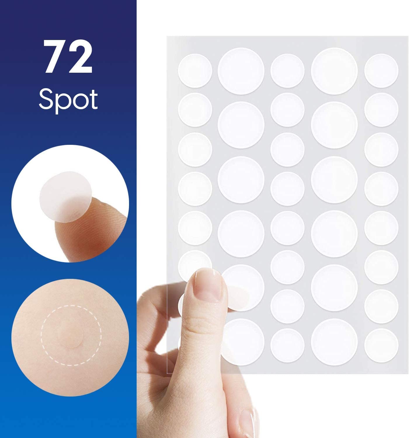 BLAGO Hydrocolloid Acne Pimple Patches for Face - 72 Count Spot Treatment for Blemishes & Breakouts | Effectively Calms & Relieves Acne | Perfect for Overnight Spot Treatment & Daily Facial Care