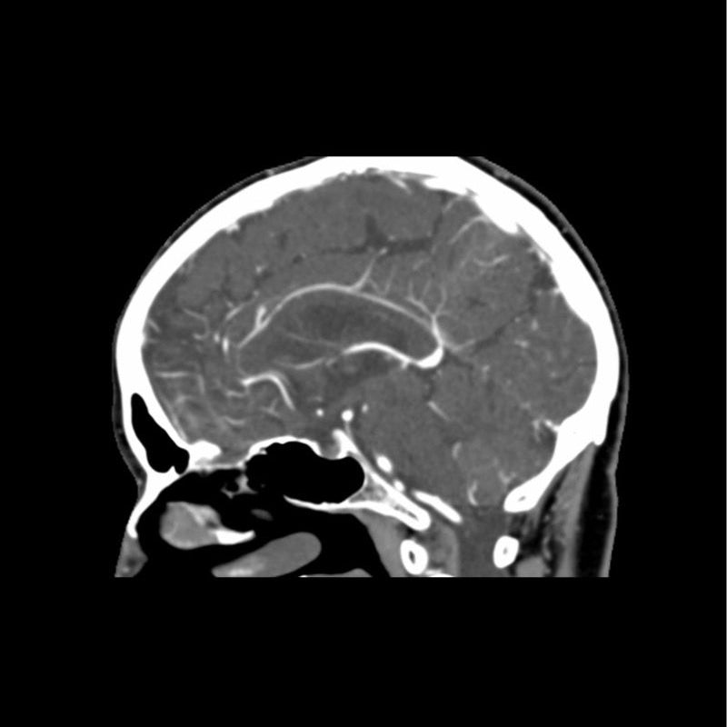 CTA Head Phantom for CT Scan & X-Ray Training - High-Quality Medical Imaging Education Tool for Radiology Students & Technicians
