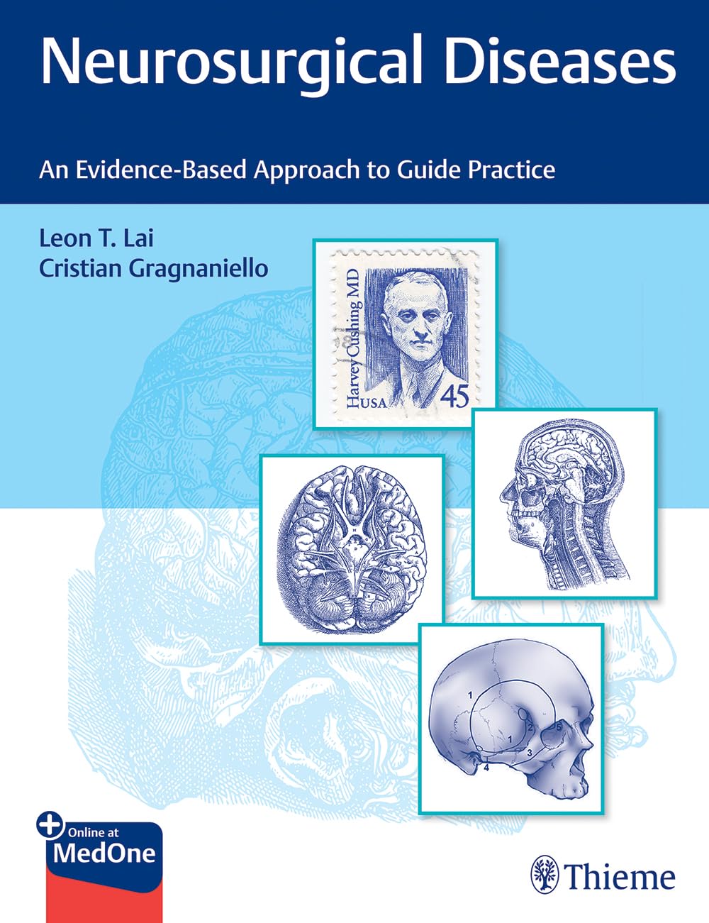 Neurosurgical Diseases: Evidence-Based Guide for Medical Practice - Essential for Neurosurgeons & Healthcare Professionals in Clinical Settings