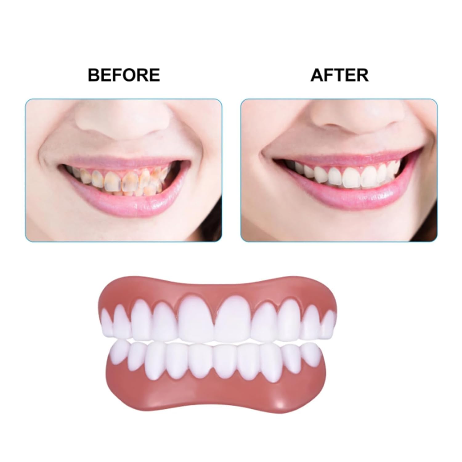 Yunpso Denture Reline Kit - Soft Silicone Denture Repair Kit for Men & Women (1 Set) | At-Home Denture Adjustment & Comfort Solution for Loose Dentures