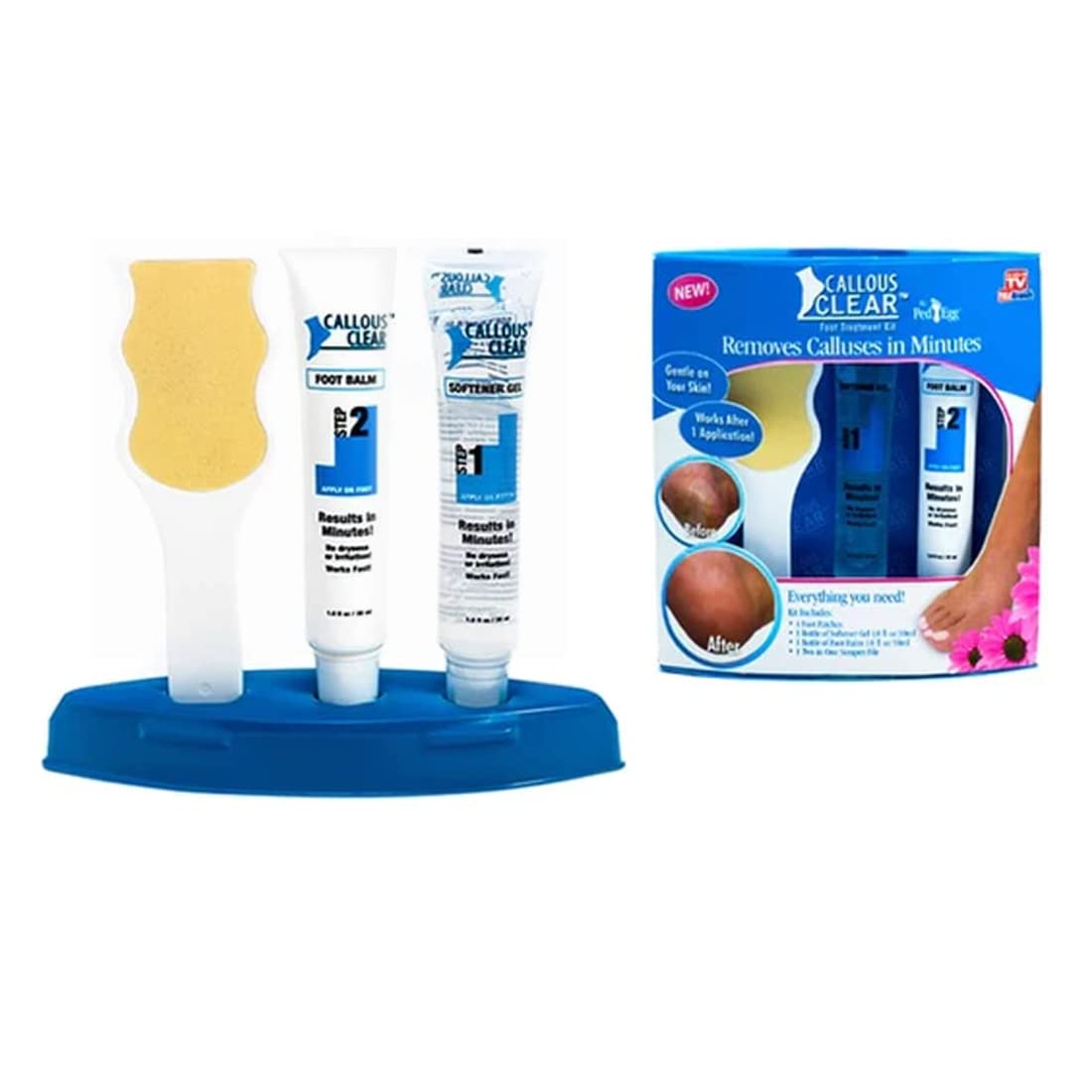 Callous Clear Foot Treatment Kit - Deluxe Foot Cream & Heel Balm with Scraper & File for Smooth Soft Feet | Cracked Heel Repair, Dry Skin Care, Pedicure at Home