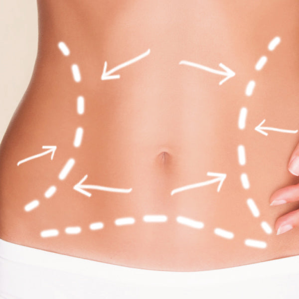 InMode BodyFX - Non-Invasive Fat Reduction & Body Contouring System for Cellulite Treatment and Skin Tightening | Perfect for Home & Professional Use in Spas, Clinics, and Medspas