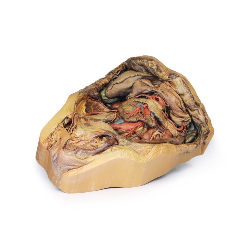 3D Printed Abdomen Model with Inguinal Hernia - Medical Training & Anatomy Study Tool for Students, Doctors & Surgeons