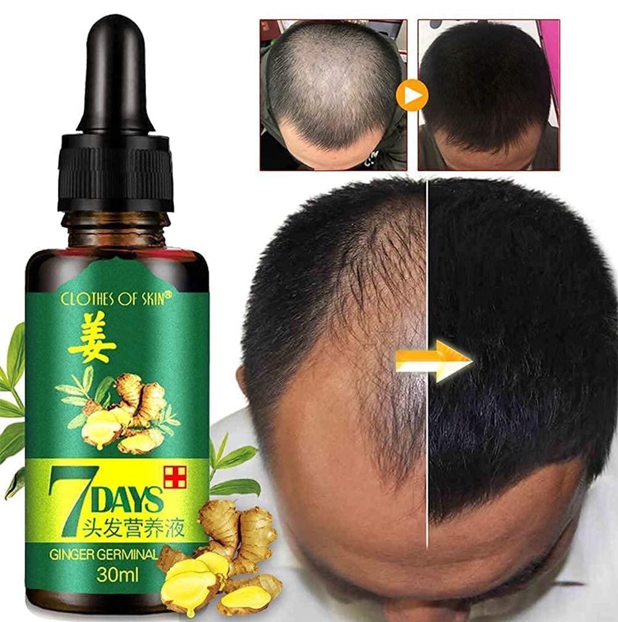 7 Day Hair Growth Treatment - Ginger Serum Essence for Thicker Hair & Scalp Care | Reduce Hair Loss & Stimulate Growth (1 Pack) | Perfect for Men & Women with Thinning Hair at Home or Salon Use
