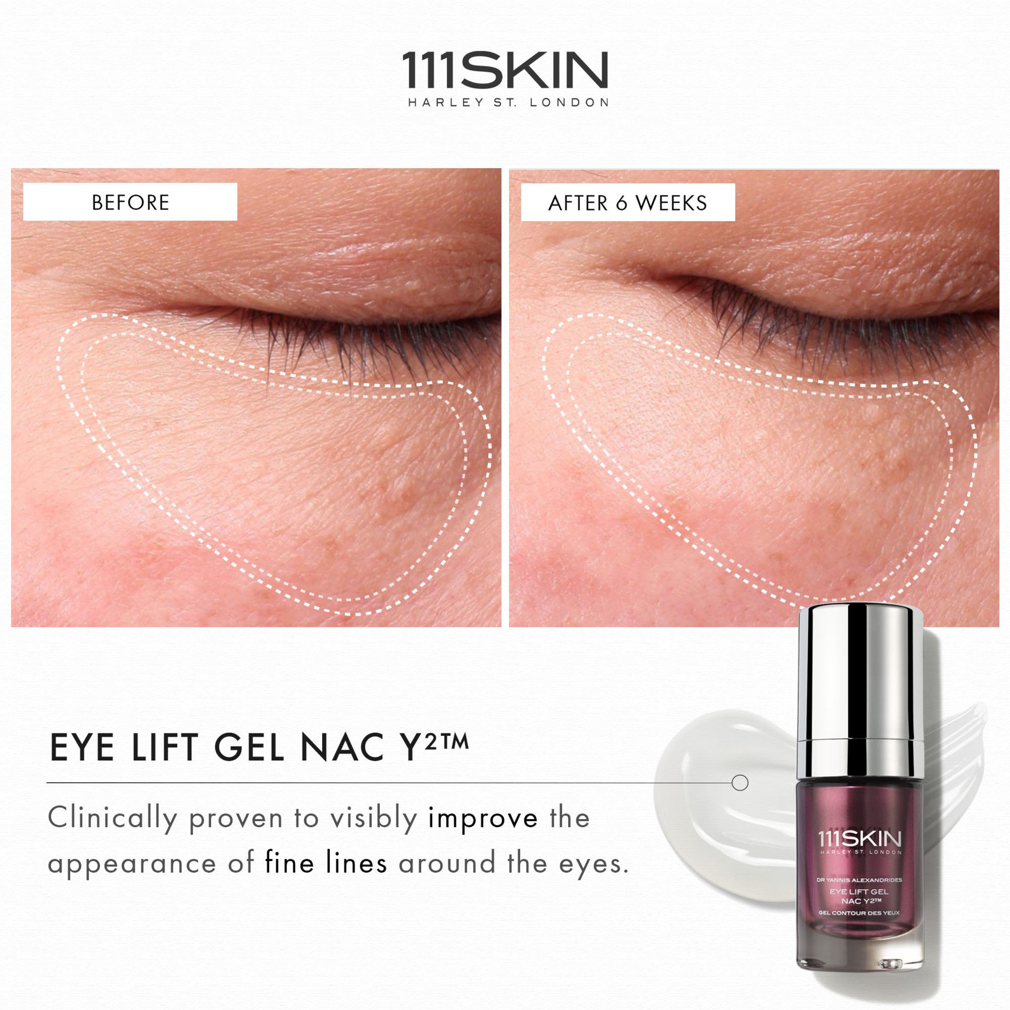 NAC Y2 Eye Lift Gel - Anti-Aging Eye Cream for Dark Circles & Puffiness - Best for Wrinkles & Fine Lines - Perfect for Morning & Night Skincare Routine