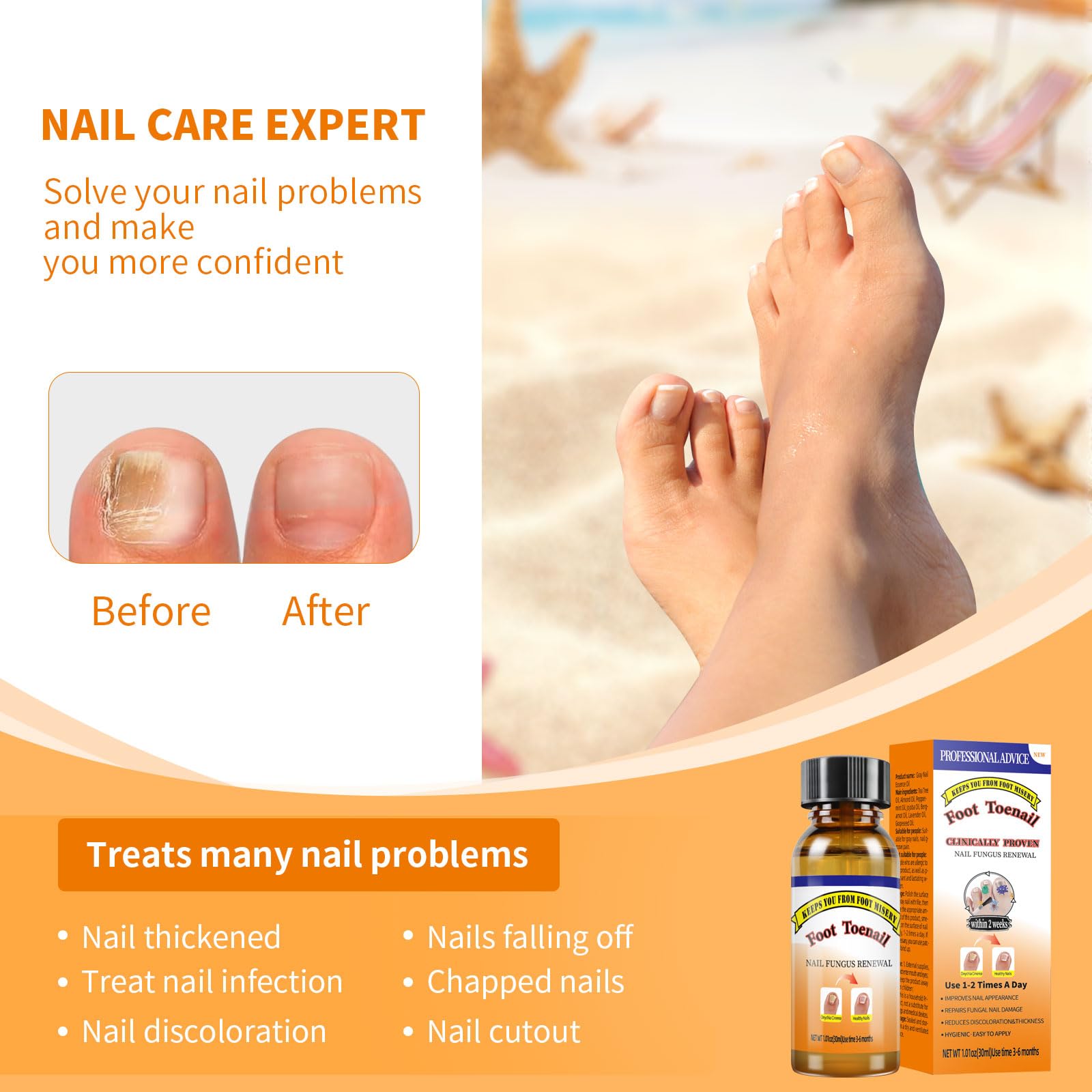 Extra Strength Toenail Fungus Treatment Fluid with Soft Brush Head - 30ML for Fast & Effective Nail Fungus Removal | Home Foot Care Solution for Athletes, Swimmers & Daily Use