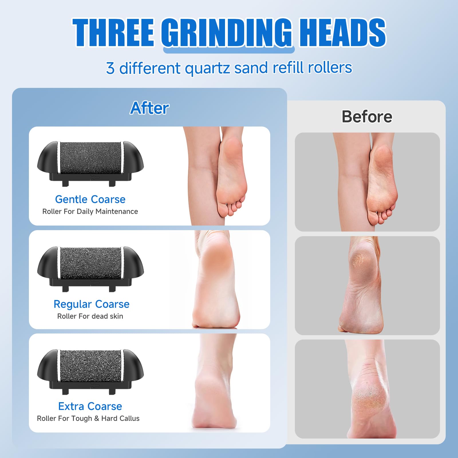 Professional Electric Callus Remover for Feet - Rechargeable Waterproof Pedicure Tool Kit with Foot File & Dead Skin Scrubber | Perfect for Home Spa, Pedicures & Dry Cracked Heel Care