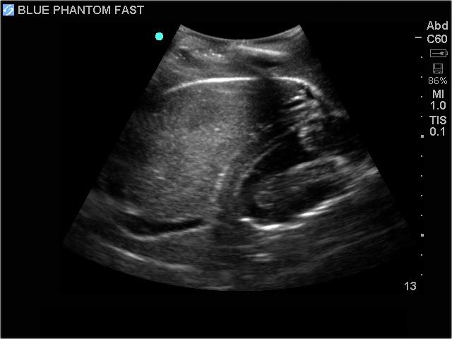 FAST Exam Real Time Ultrasound Training Model - Transthoracic Only for Emergency Medicine & Trauma Assessment Practice (Medical Simulation, Sonography Education, TTE Training)