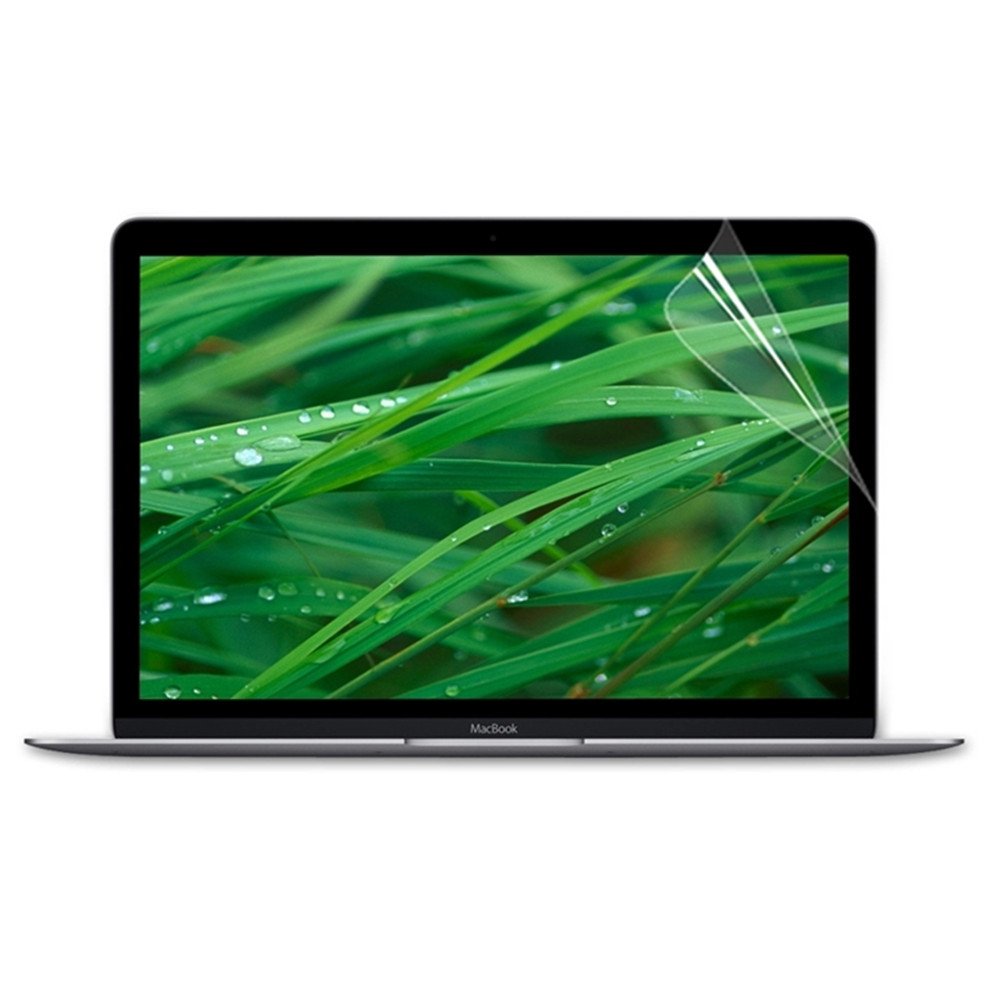 Se7enline MacBook Air 13 Inch Case (2023-2018 Models) - Hard Plastic Protective Cover with Keyboard Protector & Screen Protector | Compatible with Touch ID Version A1932 | Starry Sky Design - Perfect for Work, Travel & School Use