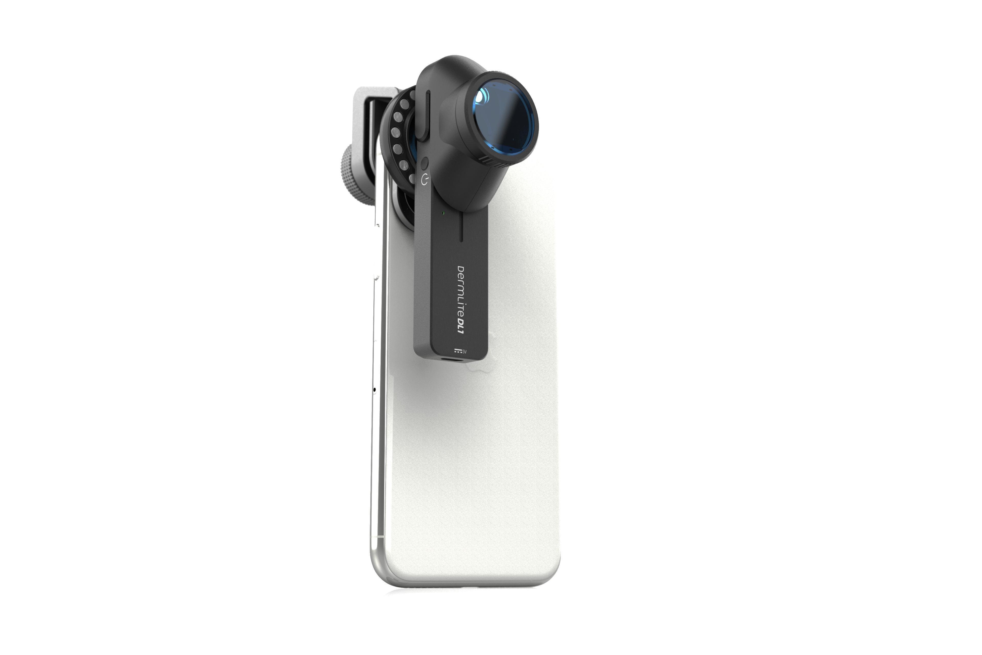 DermLite DL1 Basic Dermatoscope - Portable Skin Examination Tool for Dermatologists | Ideal for Mole Checks, Skin Cancer Detection & Clinical Diagnosis