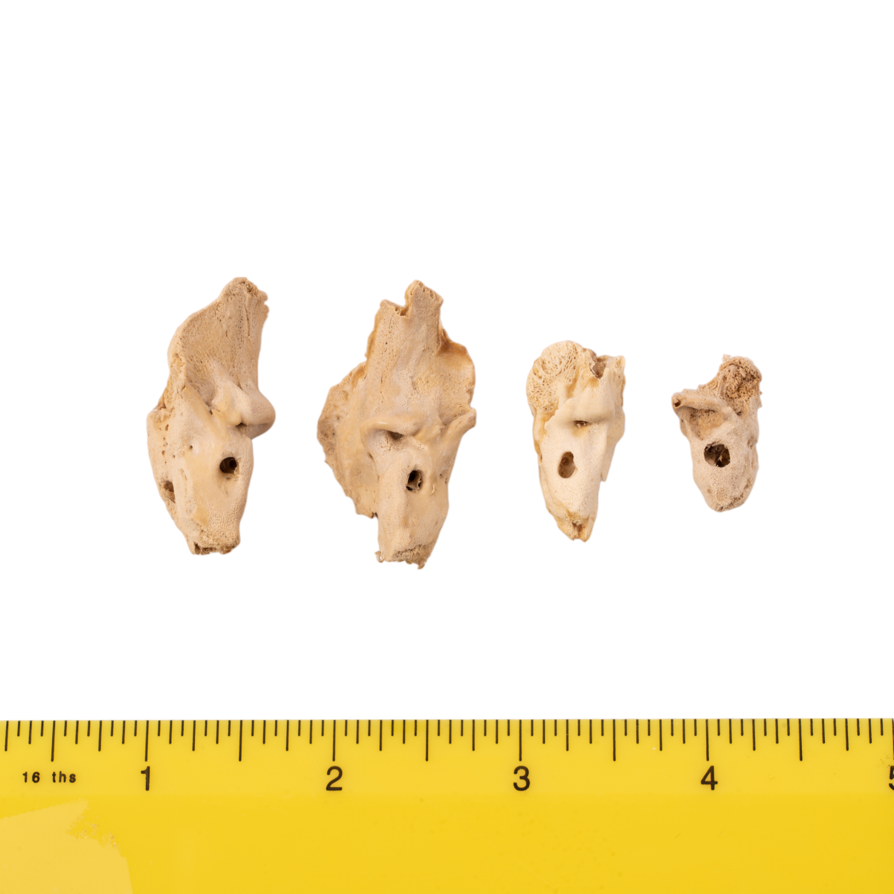 Premium Human Fetal Petrous Bone Specimen for Medical Research - Ideal for Anatomical Studies, Forensic Analysis, and Biological Research