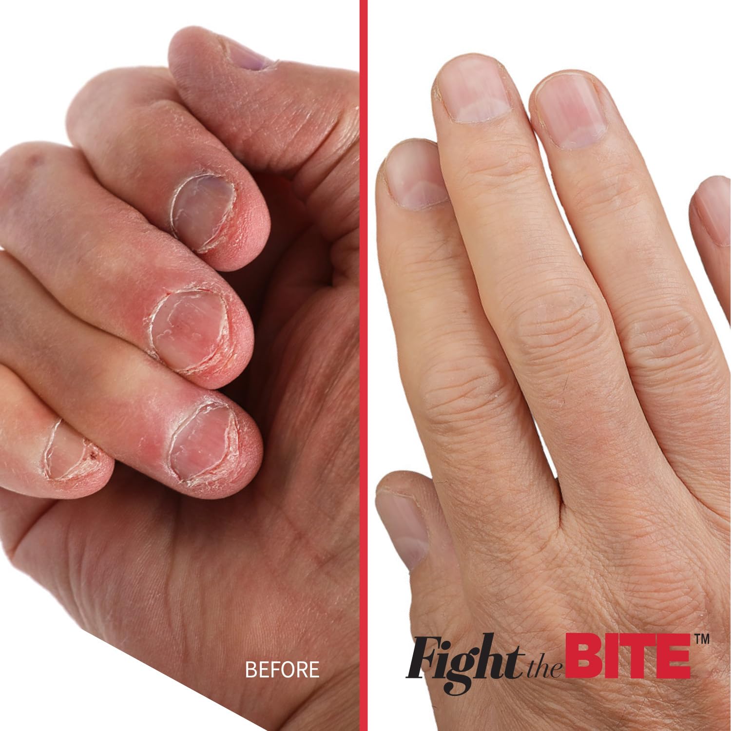 Cuccio Fight The Bite Clear No Bite Nail Polish for Women & Men - Bitter Taste to Stop Nail Biting - Promotes Healthy Nail Growth - 0.5 Fl Oz - Perfect for Home, Office & Travel Use