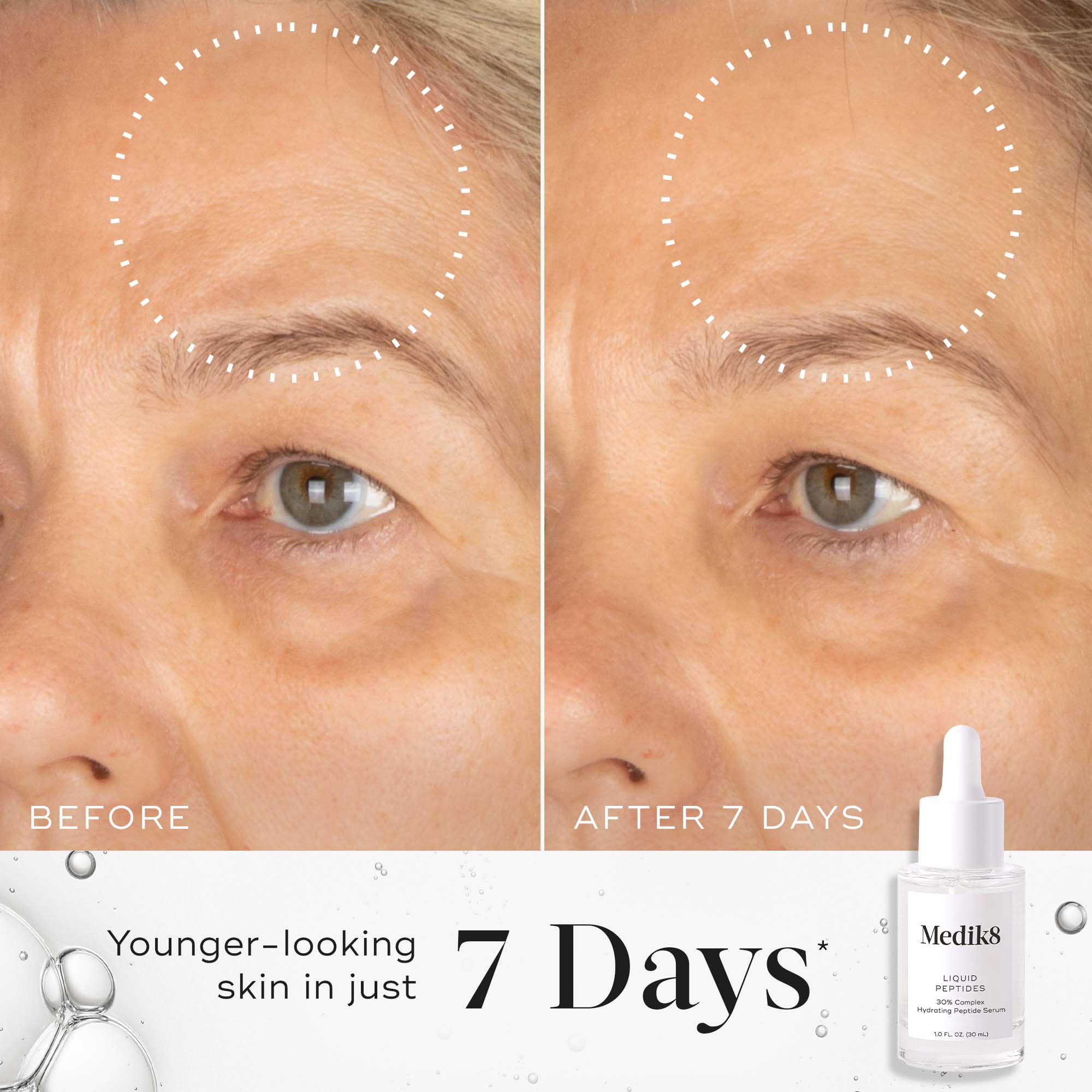Liquid Peptides™ - Premium Collagen Peptides for Skin & Joint Health | Anti-Aging Supplement | Supports Hair & Nail Growth | Perfect for Smoothies, Coffee & Post-Workout Recovery