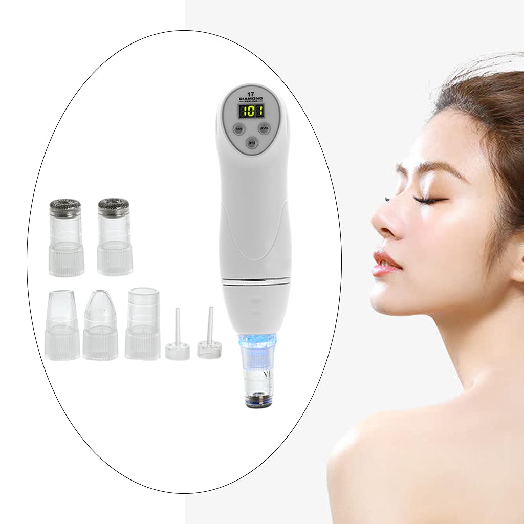Professional Losa Blackhead Remover Tool - Deep Cleansing Pore Vacuum for Face & Nose - Acne Extractor & Blackhead Suction Kit - Perfect for Daily Skincare & Spa Treatments