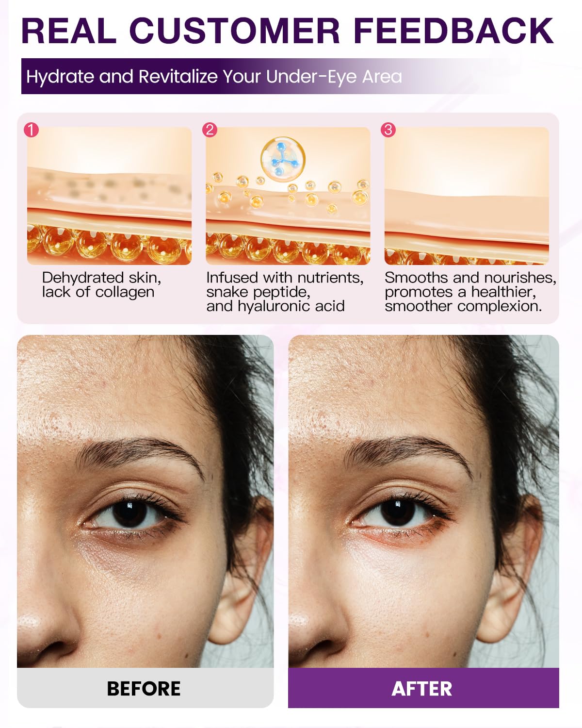 Snake Venom Collagen Under Eye Patches - Hydrating Anti-Aging Eye Mask for Puffy Eyes, Dark Circles & Wrinkles with Hyaluronic Acid & Centella Asiatica - Perfect for Night Routine & Travel Skincare