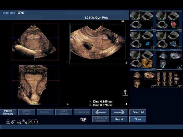 General Pathology Transvaginal Ultrasound Training Model - High-Quality Medical Simulation for OB/GYN Education & Clinical Practice - Perfect for Medical Schools, Hospitals & Diagnostic Labs