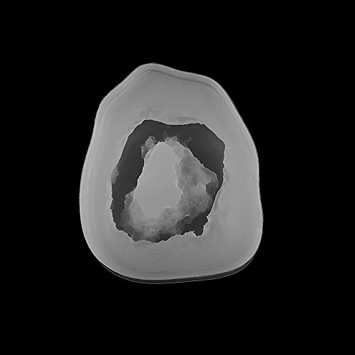 04 Mold