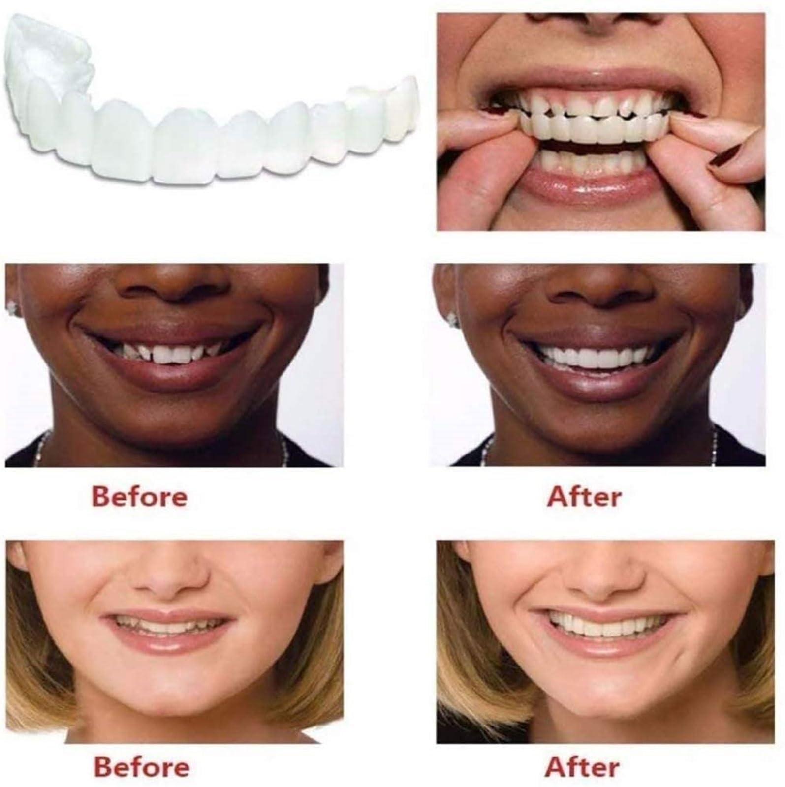 Natural & Comfortable Temporary Fake Teeth for Women & Men - Cosmetic Denture Veneers for Upper & Lower Jaw to Regain Confident Smile | Perfect for Parties, Weddings, and Daily Wear