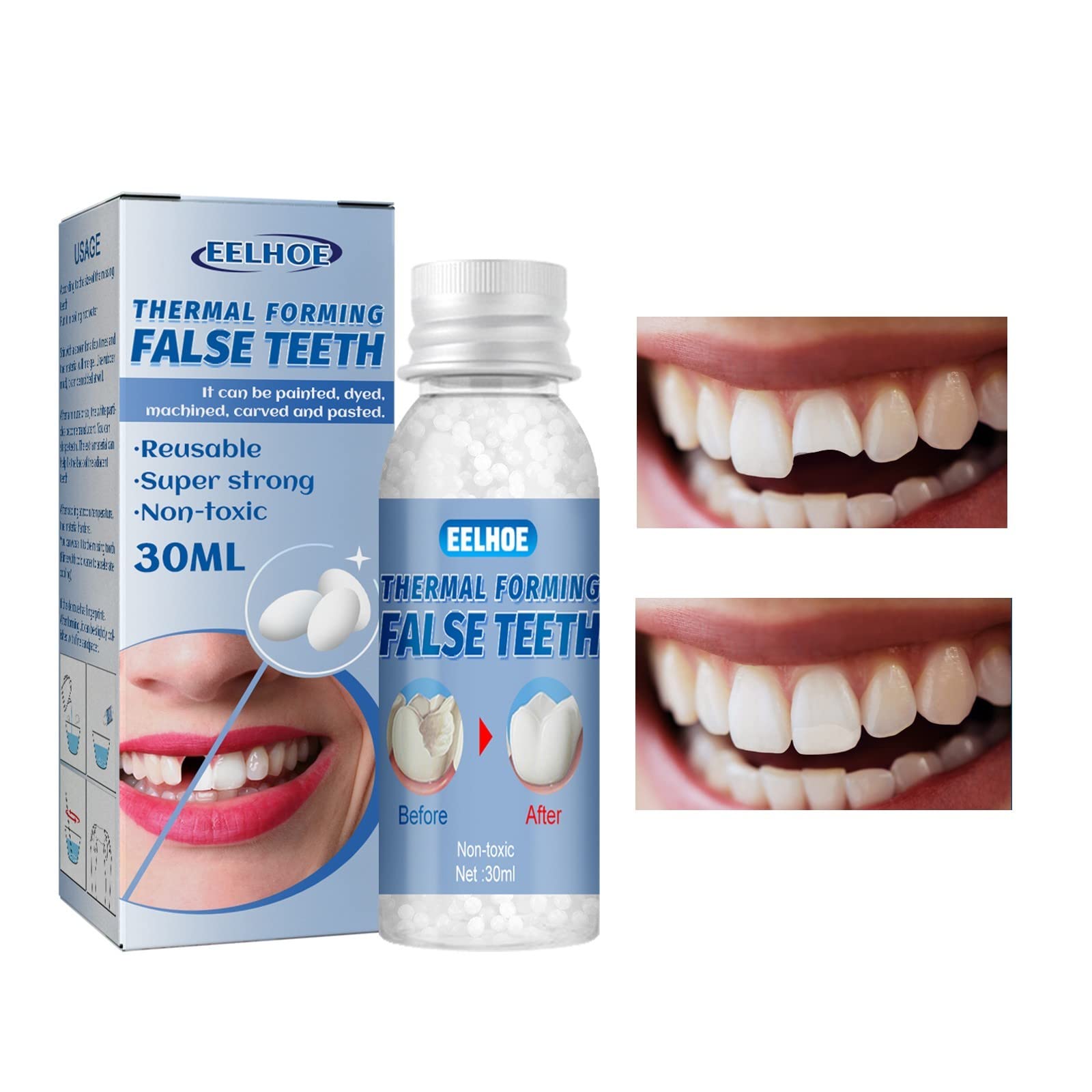 Temporary Tooth Repair Beads Kit - Fake Teeth Replacement for Missing & Broken Teeth | Emergency Dental Solution for Travel, Camping & Daily Use