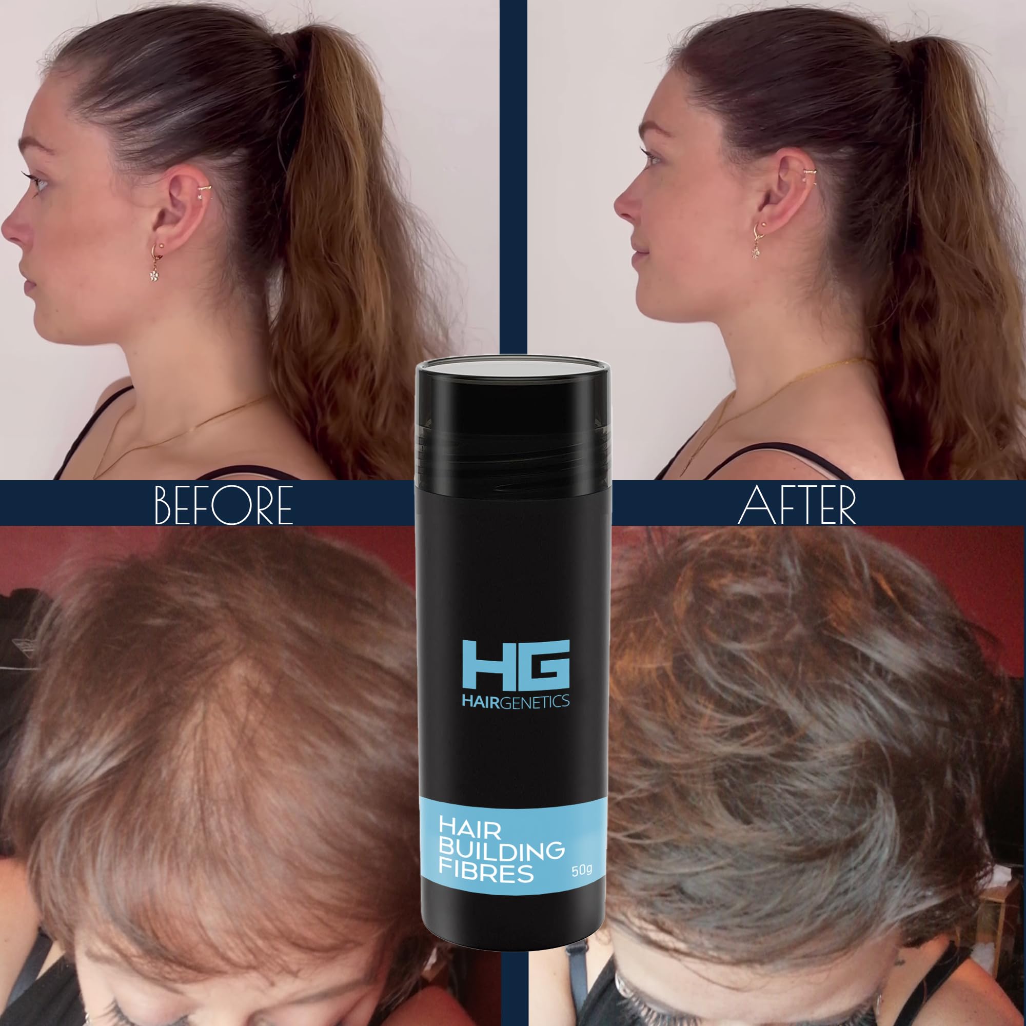 Medium Brown Hair Fibers for Hair Loss - 22g Hair Thickening Fibers for Men & Women - Covers Thin Hair & Bald Spots - Natural-Looking Hair Fibers for Thicker Fuller Hair - Perfect for Daily Use, Work, and Special Occasions