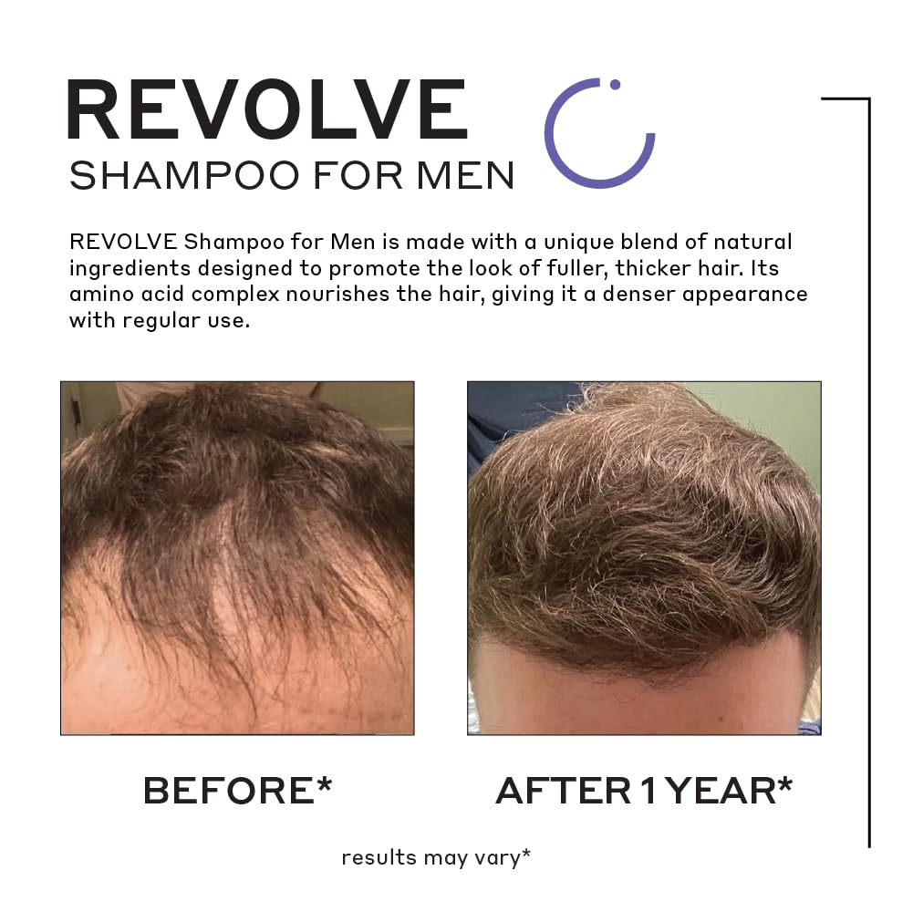 Zenagen Revolve Hair Growth Treatment for Men - Clinically Proven Thickening & Anti-Hair Loss Solution - Best for Thinning Hair & Receding Hairline - Daily Use for Healthier, Fuller Hair