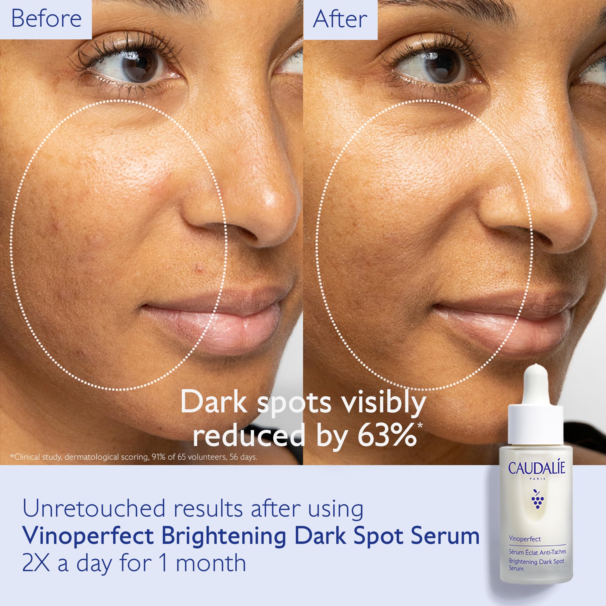 Caudalie Vinoperfect Radiance Serum for Dark Spots & Travel Size Grape Water Facial Mist - Brightening Skincare Set for Hyperpigmentation, Even Tone - Perfect for Daily Routine, Travel & On-The-Go Hydration
