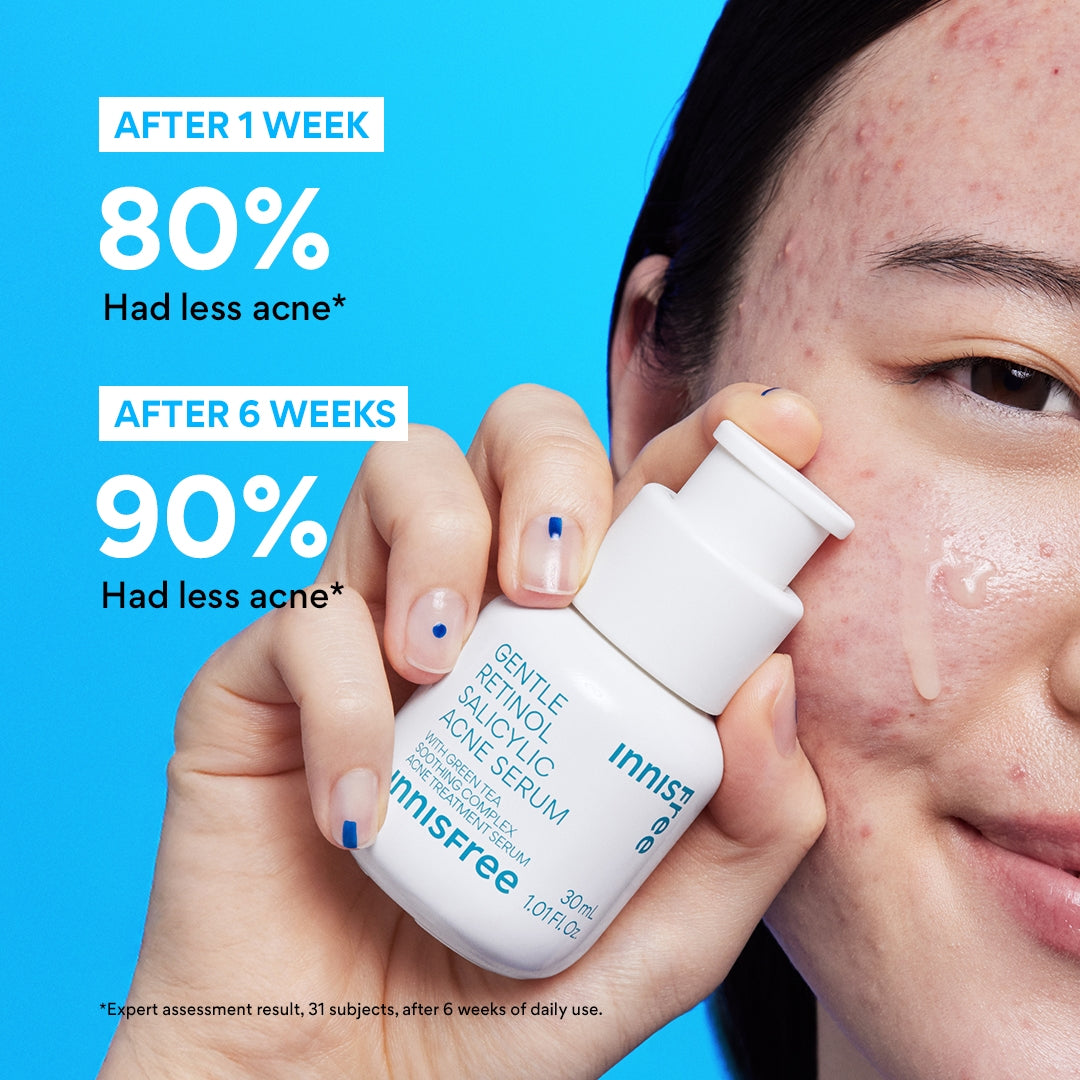 Gentle Retinol Power Duo - Anti-Aging Skincare Set for Sensitive Skin | Night Cream & Serum for Wrinkles & Fine Lines | Perfect for Daily Skincare Routine