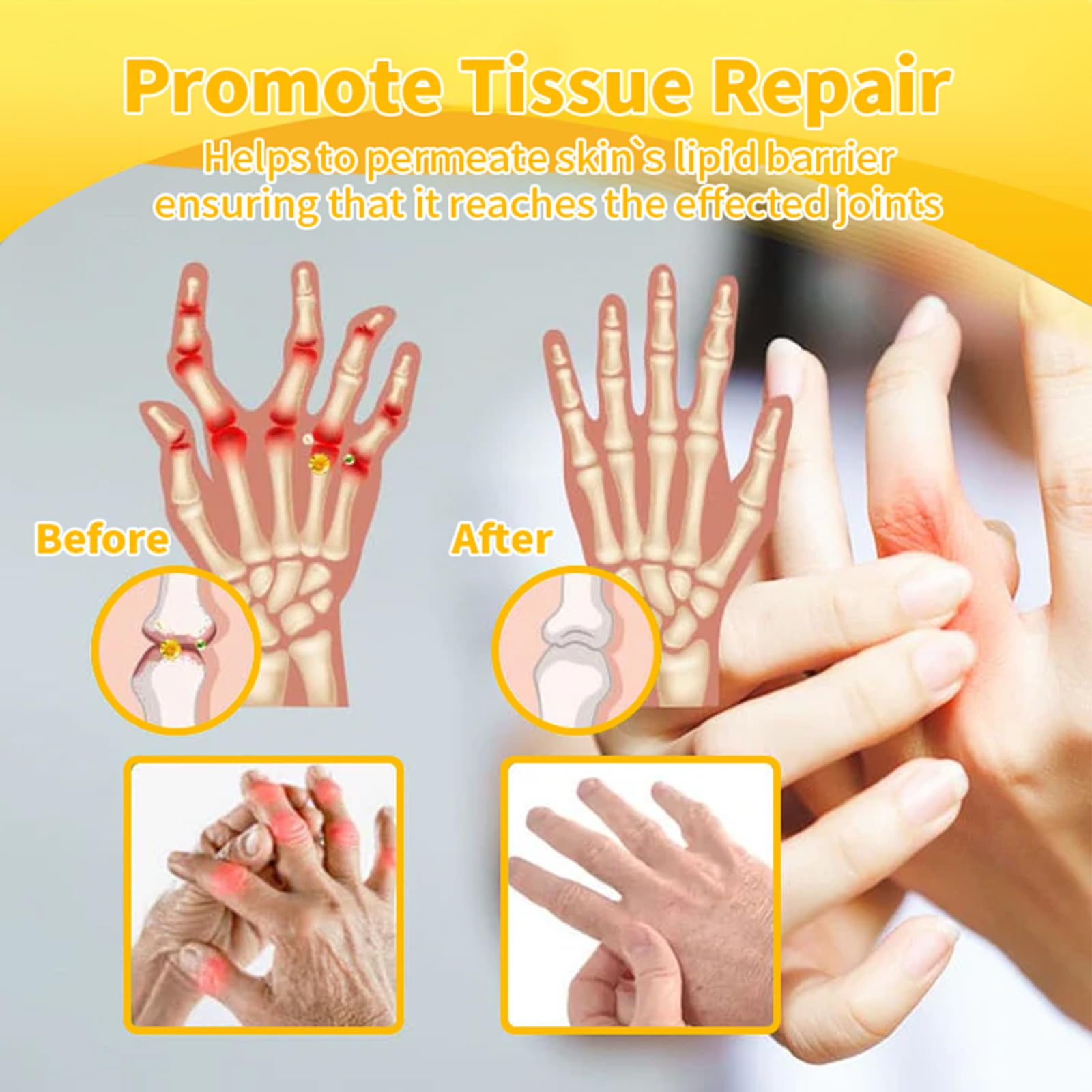 Professional Botulinum Toxin & Bee Venom Pain Relief Cream - Natural Joint & Bone Therapy Gel for Back, Neck, Hands & Knee Pain - Effective Muscle & Arthritis Relief - Ideal for Athletes, Office Workers & Seniors (1 Pack)