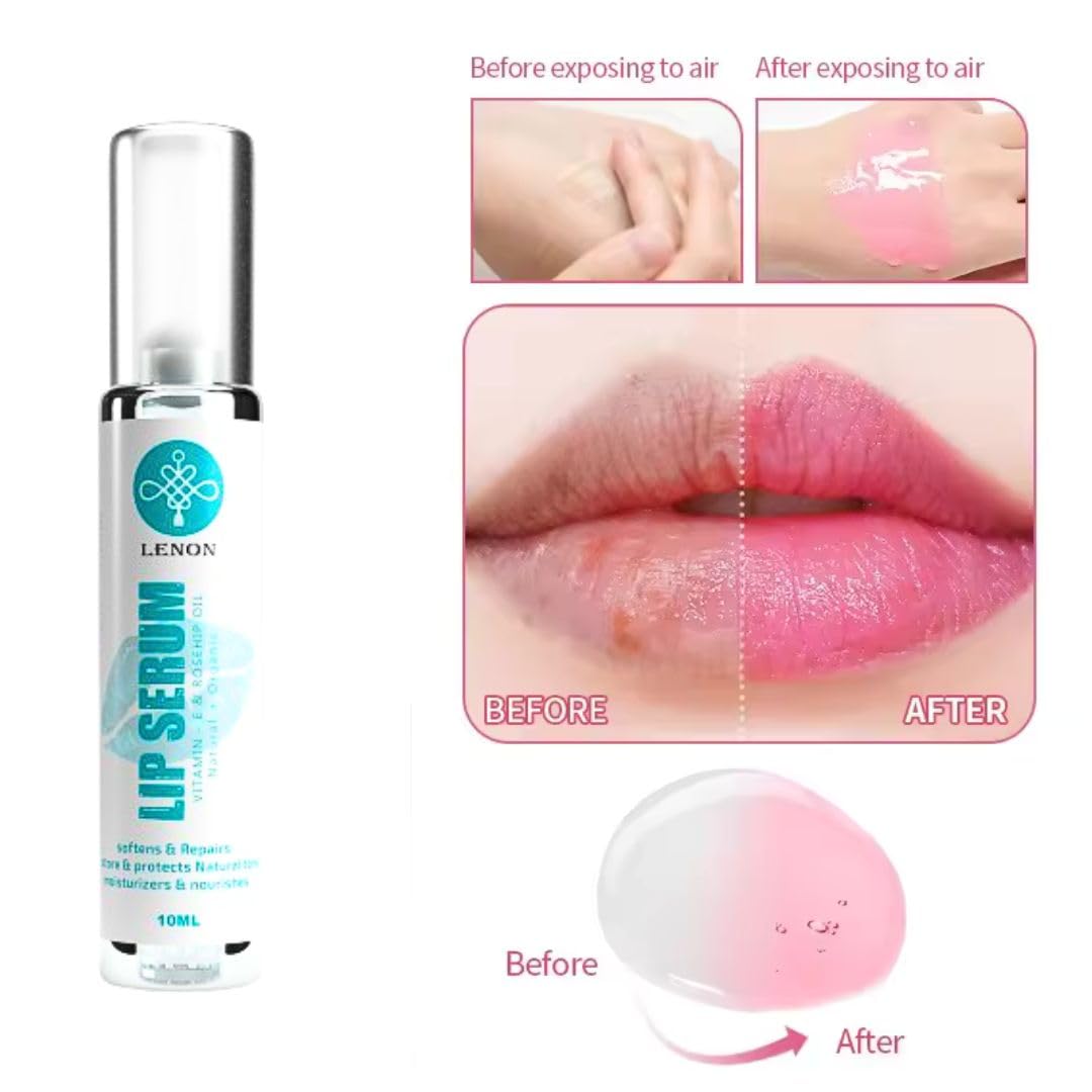 Lenon Vitamin E & Rosehip Oil Lip Serum Balm - Hydrating & Nourishing Treatment for Dry, Chapped Lips (Pack of 2) | Perfect for Winter Care & Daily Lip Moisturizing