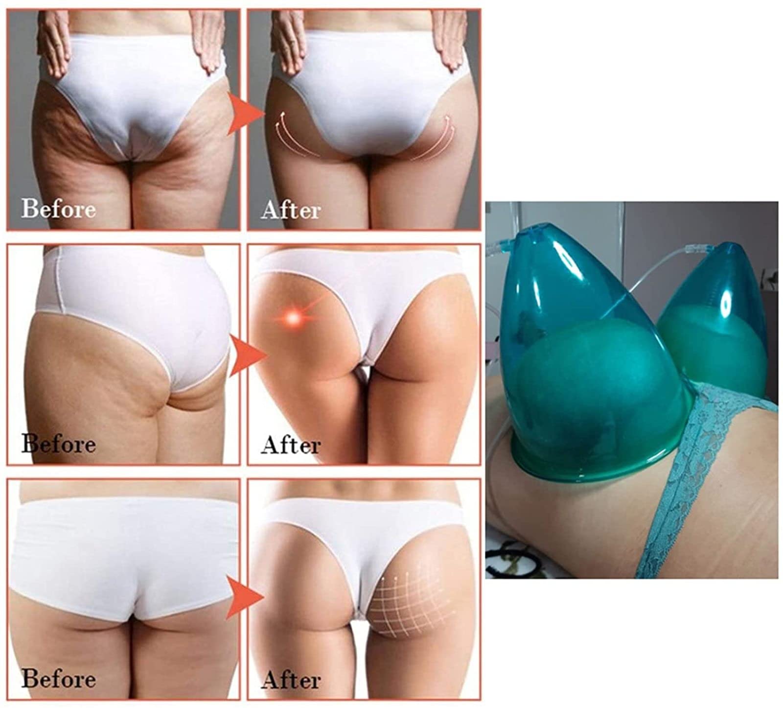 180ML Large Capacity Vacuum Suction Cup for Buttocks Lift & Body Massage - Pink Cupping Therapy Accessories for Women - Perfect for Home Spa, Cellulite Reduction & Relaxation Therapy