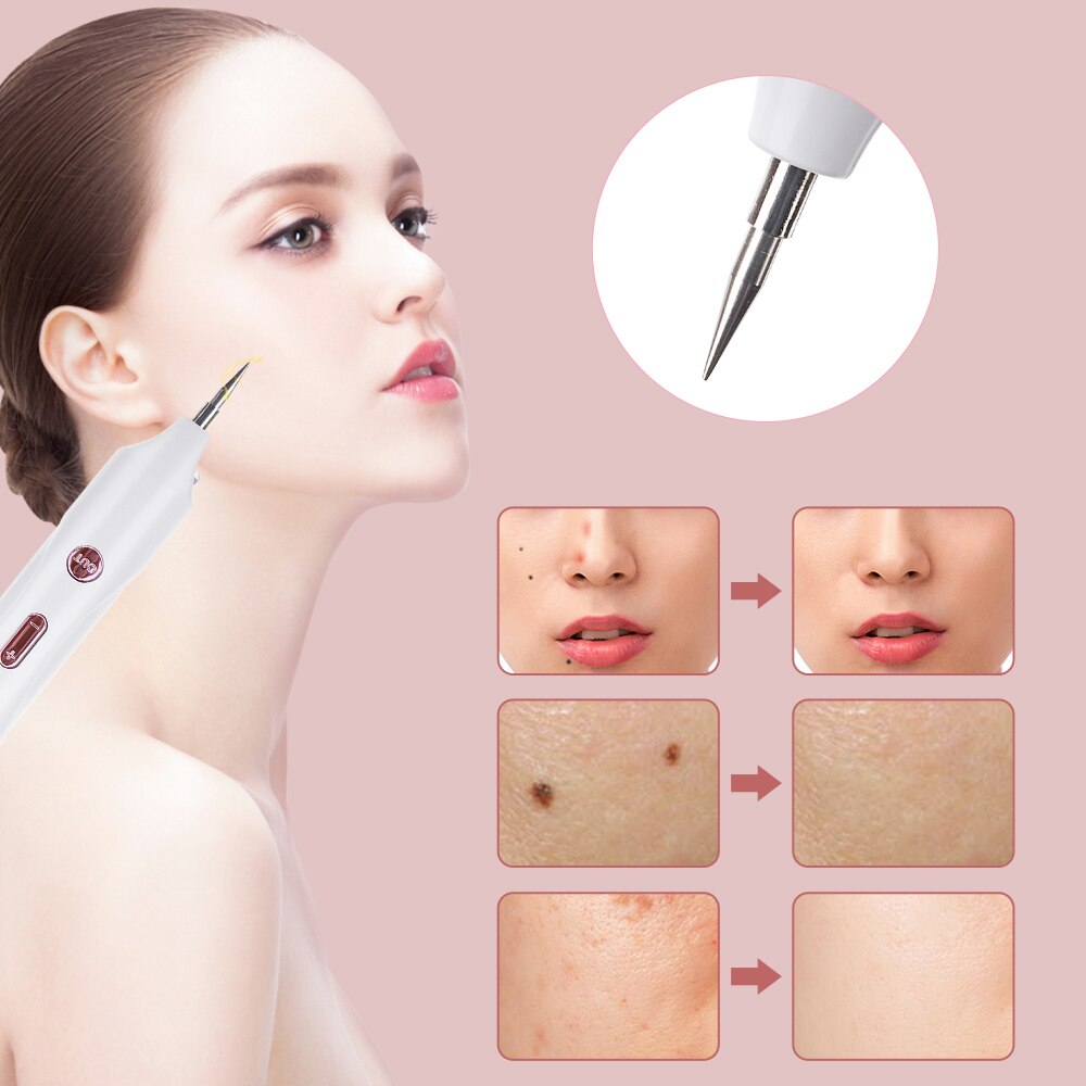 Mole Tattoo Freckle Plasma Pen - Permanent Skin Tag & Mole Removal Device - Perfect for DIY Beauty Treatments at Home