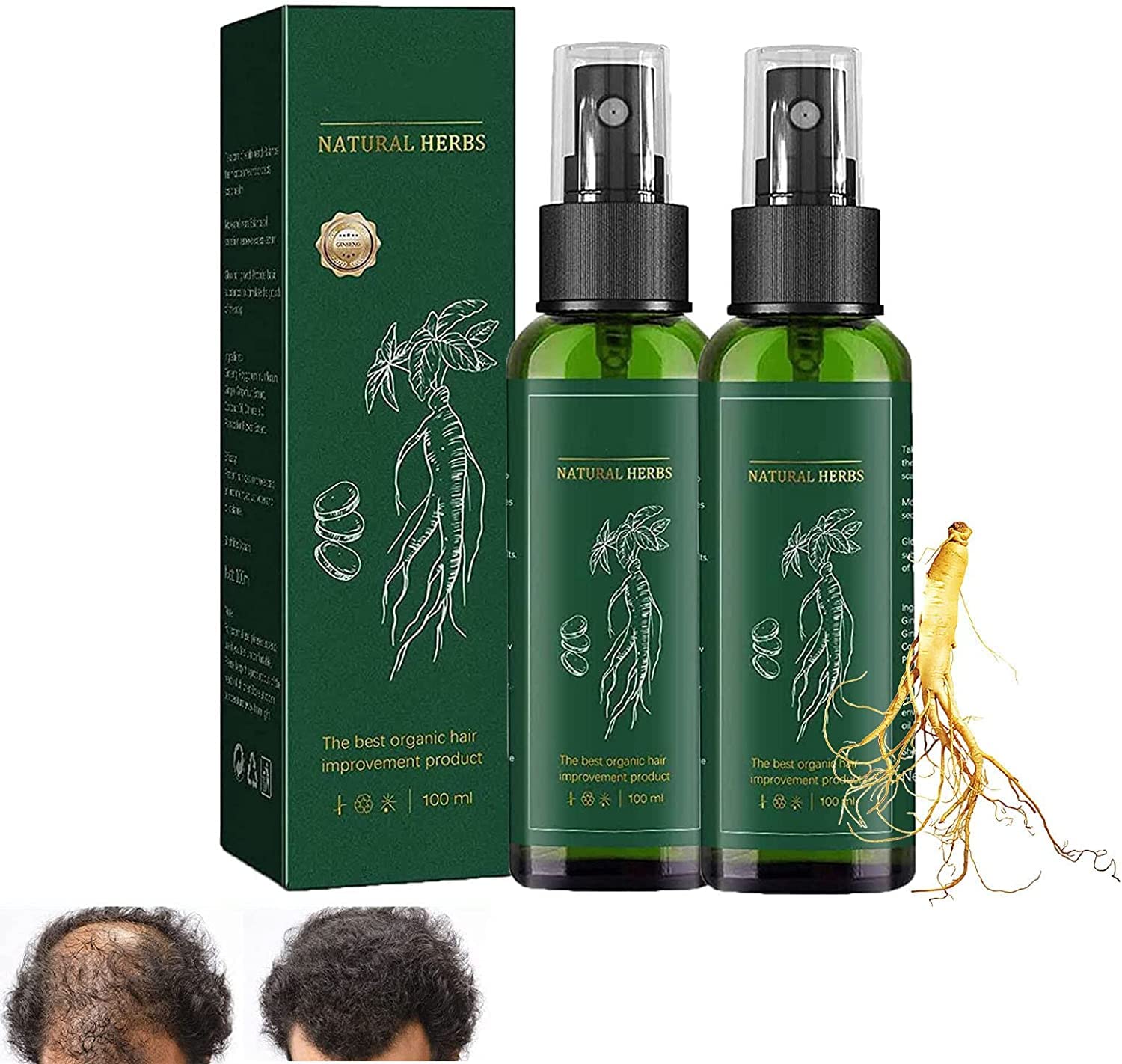 KORTIN Korean Red Ginseng Hair Regrowth Spray - Natural Herbal Hair Growth Serum for Women & Men with Ginger Extract (2 Pack) | Stimulates Hair Follicles & Reduces Hair Loss for Thicker, Healthier Hair