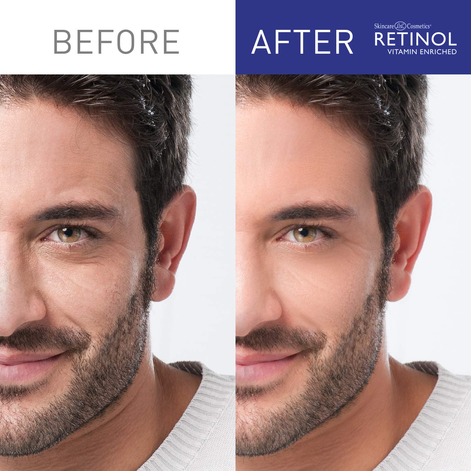 Retinol Skincare Gift Set for Men - Daily Moisturizer, Eye Cream, Facial Serum, Gel Cleanser & Blackhead Remover | Anti-Aging & Acne Treatment | Perfect for Father's Day, Birthday & Self-Care Routine