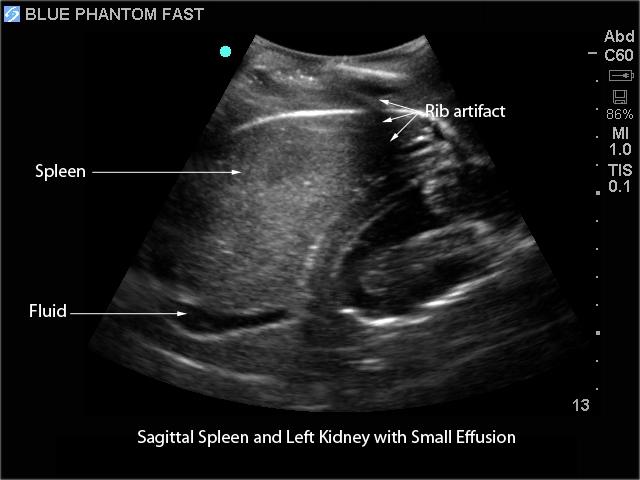 FAST Exam Real Time Ultrasound Training Model - Transthoracic Only for Emergency Medicine & Trauma Assessment Practice (Medical Simulation, Sonography Education, TTE Training)