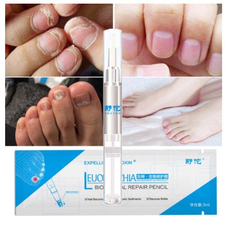 PerfectBuy 3ML Nail Fungus Treatment - Fast-Acting Antifungal Solution for Toenail & Fingernail Infections - Doctor Recommended for Home Use & Daily Foot Care