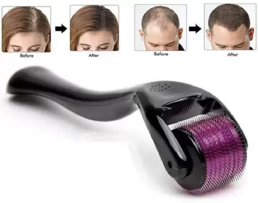 Redtize 0.5mm Titanium Micro Needle Roller for Hair Growth - 540 Medical Grade Needles | Repair Damaged Hair & Stimulate Follicles | Reduce Hair Loss & Thicken Hair | Easy to Use at Home | Perfect for Men & Women with Thinning Hair