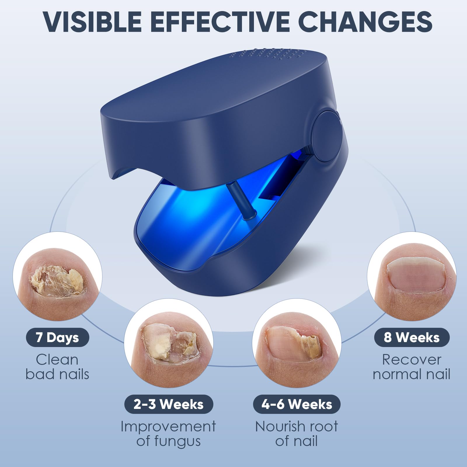 Best Nail Fungus Laser Treatment Device for Fingernails & Toenails | FSA/HSA Eligible Home Light Therapy | Effective Toenail Fungus Remover for Daily Use at Home or Travel