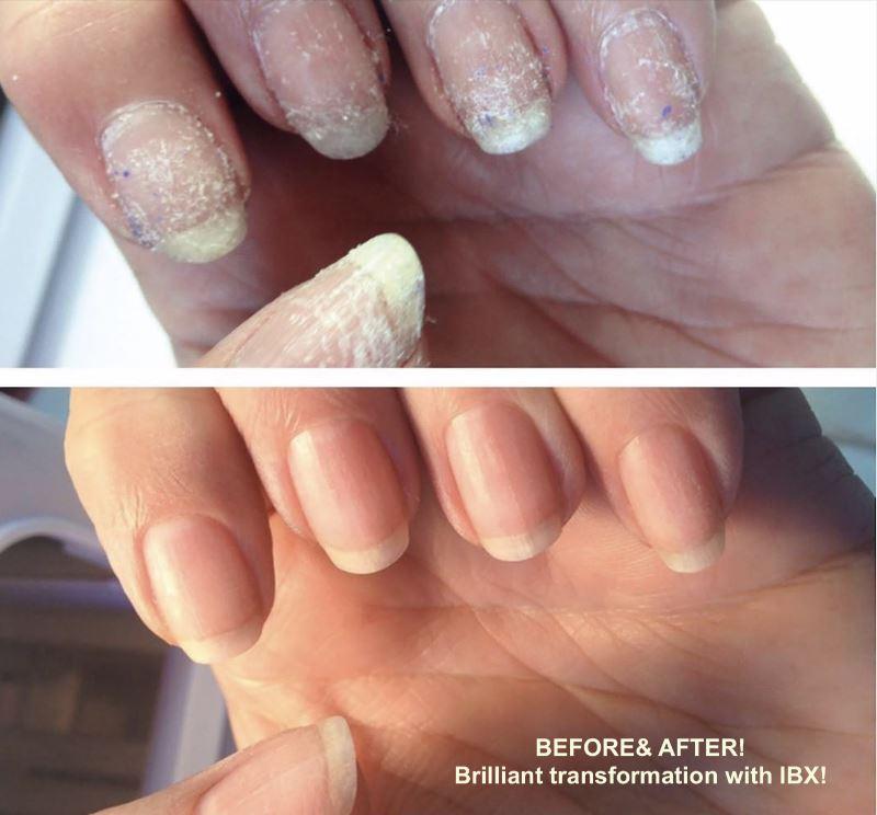 IBX Nail Strengthener & Repair Kit - TRIO PACK with FREE Cuticle Oil | Professional Nail Care Treatment for Weak, Damaged & Brittle Nails | At-Home & Salon Use