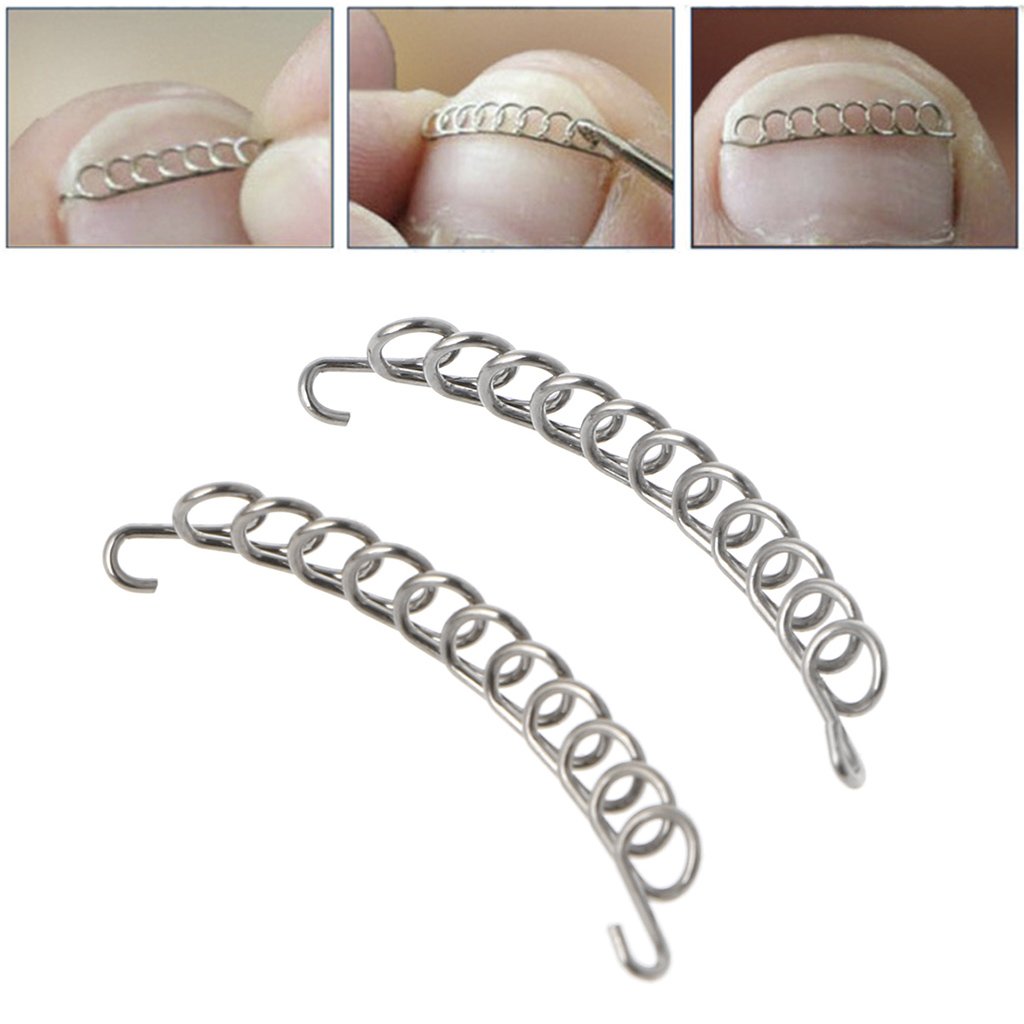 Ingrown Toenail Corrector Tool - Professional Pedicure Wire Fixer for Ingrown Nail Treatment & Paronychia Recovery - Perfect for Home Nail Care & Pain Relief