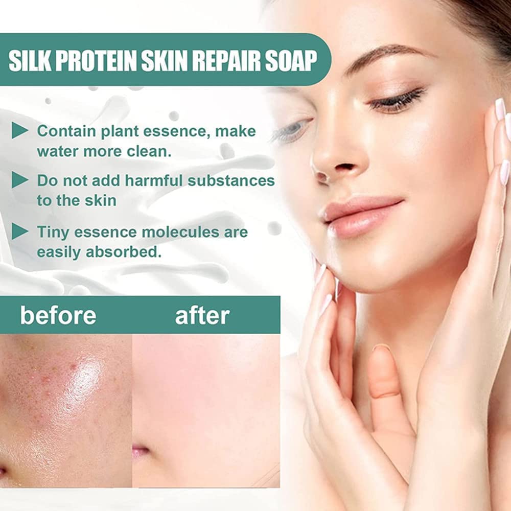 SkinFerm Back Acne Treatment Soap with Silk Worm Cocoon & Collagen - Whitening & Skin Repair Soap for Face & Body (3 Pack) - Gentle Cleansing for Acne-Prone Skin, Daily Skincare Routine